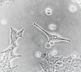 Human embryonic kidney (HEK293) cells cultured in vitro. Microscopic phase contrast image. Such...