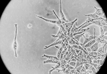 Human embryonic kidney (HEK293) cells cultured in vitro. Microscopic phase contrast image. Such...