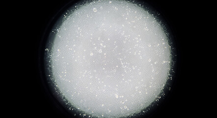 Human embryonic kidney (HEK293) cells cultured in vitro. Microscopic phase contrast image. Such...