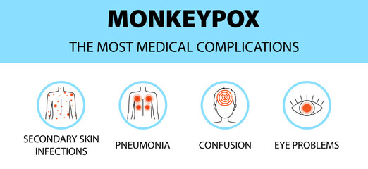 Monkeypox virus icons infographic. The most medical complications. New outbreak cases in Europe and USA.