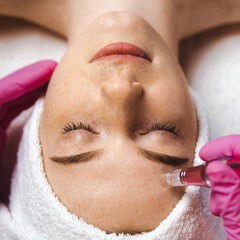 Woman receiving procedure microdermabrasion on the face against acne. Professional beauty salon....