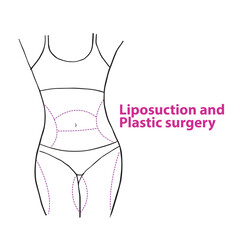 Plastic surgery and liposuction. Woman body, surgery and skin liposuction, Simple line element Liposuction.