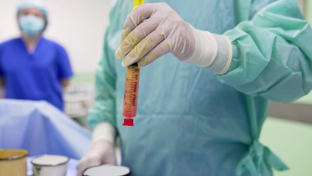 Doctor’s hand in latex gloves hold a syringe filled with stem cells. Close up. Female medic standing at backdrop in blur.