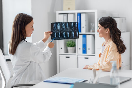 medicine, healthcare and people concept - smiling female doctor or vertebrologist showing x-ray image of spine to woman patient at hospital