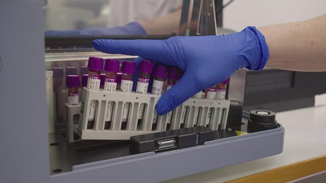 Nurse putting multiple trays with samples into the blood analysis machine. Analyzing the blood test samples of the patients. Analyzing the health of blood in plastic sample tubes. Healthcare.