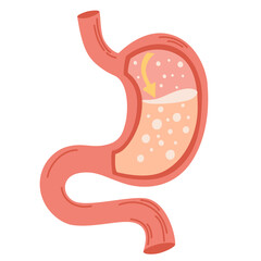 Obraz premium Human stomach. Gastroesophageal reflux disease concept. Unhealthy stomach concept. Heartburn, illness, discomfort, pain. Flat vector illustration isolated on white