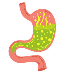 Human stomach. Gastritis and acid reflux, indigestion, vomiting, heartburn and stomach pain problems. Unhealthy stomach concept. Heartburn, illness, discomfort, pain. Flat vector illustration