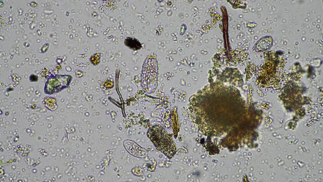 soil microbes organisms in a soil and compost sample, fungus and fungi and under the microscope in regenerative agriculture. in australia.
