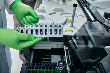Lab technician downloads blood test samples to biochemical automatic blood analyzer for blood biochemistry in modern medical laboratory