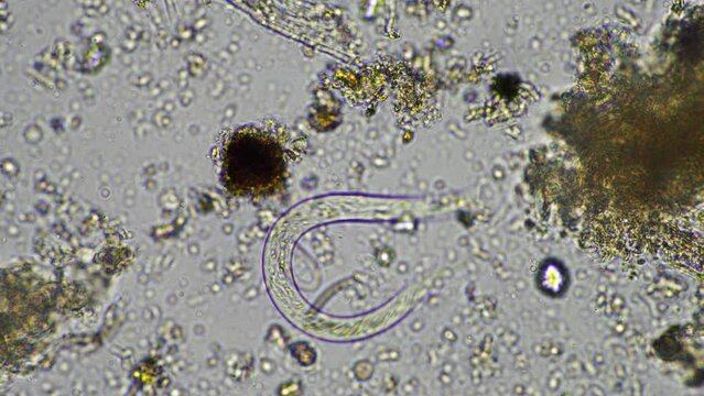 human parasite. gut intestinal infection disease. microorganism infection in hospital 
