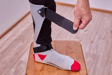 Foot orthosis ankle and leg support for foot drop.