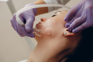 Woman Getting Vacuum Cleaning Face Treatment At Beauty Clinic