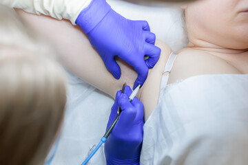 The master of electrolysis in blue sterile gloves performs the procedure for removing unwanted hair using electrolysis