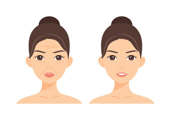 Woman with Wrinkles on Face. Wrinkles on Forehead, near Eyes, Mouth and Neck. Treatment. Before After. Lady with a Smile and Smooth Skin. Color Cartoon style. White background. Vector illustration.