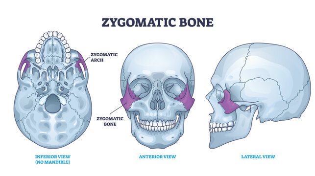 Zygomatic bone location with human skull skeleton anatomy outline diagram. Labeled educational scheme with cheekbone from inferior, anterior and lateral view vector illustration. Head parts structure.