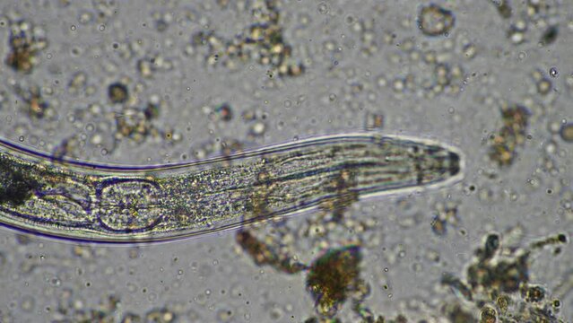 microorganisms and soil biology, with nematodes and fungi under the microscope. in a soil and compost sample