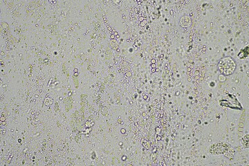 person with a virus coughing, Phlegm and mucus under the microscope