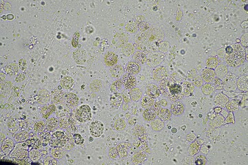 coughing, Phlegm and mucus under the microscope