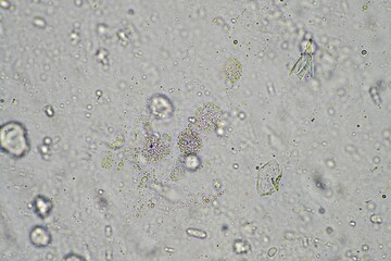 coughing, Phlegm and mucus under the microscope