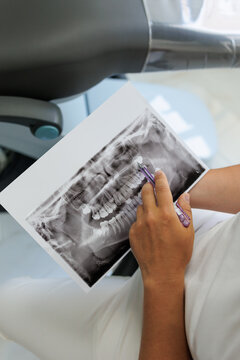 Close up view of male dentist doctor holding and looking at panoramic dental x-ray picture