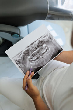 Teeth panoramic x ray professional examination
