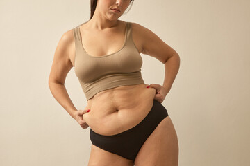 unrecognizable woman pinch abdomen side fat. Body shaming problem, normalize woman body - 523248124