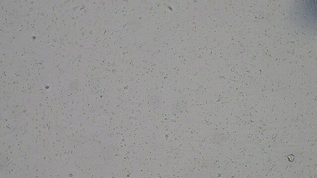 human sperm under the microscope