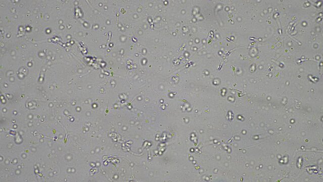 Sperm under the microscope. Looking a semen swimming. Healthy fertile man high sperm count