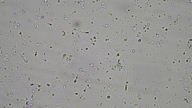 Sperm under the microscope. Looking a semen swimming. Healthy fertile man high sperm count