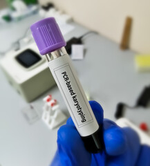 Blood sample for PCR based karyotyping testing. Genetic disorder. chromosomal analysis.