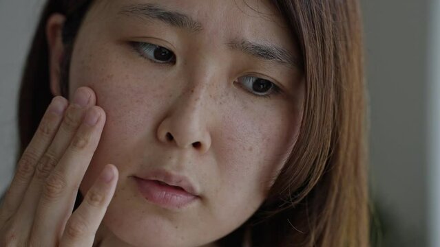 シミに悩むミドル女性（美容・肌・シミ・肝斑・すっぴん）