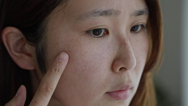 シミに悩むミドル女性（美容・肌・シミ・肝斑・すっぴん）