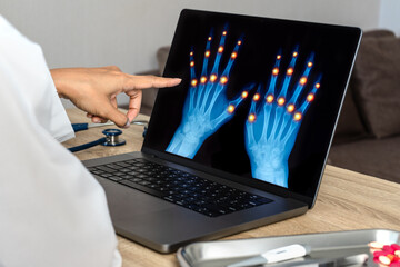 Close up of doctor showing x-ray of hands 