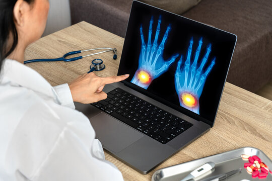 Close up of doctor showing x-ray of hands 