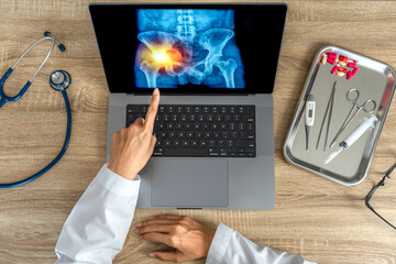 Top view of doctor looking a x-ray of pain in the hips on a laptop. 