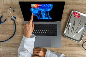 Fototapeta na wymiar Top view of doctor showing a x-ray of pain in the brain on a laptop. Migraine Headache concept