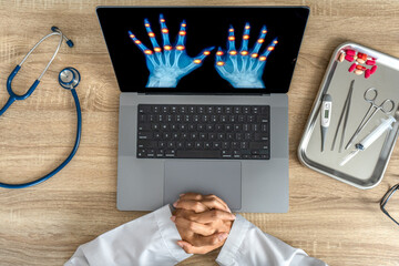 Top view of doctor looking x-ray of hands 