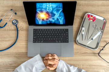 Top view of doctor looking a x-ray of pain in the hips on a laptop. 