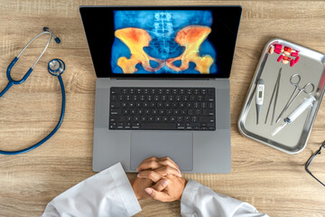 Top view of doctor looking a x-ray of pain in the hips on a laptop. 