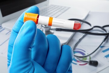doctor holding Blood tube for Virus analysis and identification.