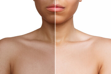 Cropped shot of a young woman before and after tanning isolated on a white background. The result of self-tanning. Tanned skin, contrast of skin colors 