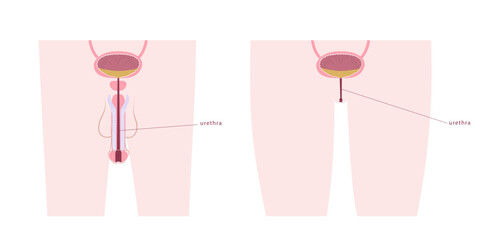 Comparative diagram of man and woman urethra. Urinary bladder anatomy on male and female silhouette.