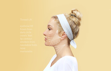 Thread Lift ,markup, thread-lift procedure for facial rejuvenation.