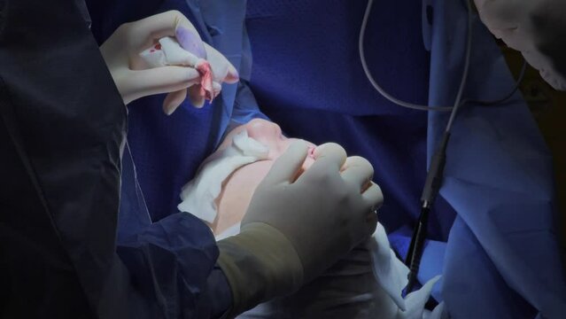 Blepharoplasty, plastic surgery operation for correcting defects, deformities, and disfigurations of the eyelids; and for aesthetically modifying the eye region of the face.