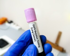 Molecular biologist holding blood sample for EGFR mutation test for the diagnosis of lung disease....