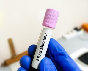 Molecular Biologist hold blood sample for  KRAS mutation test for lung cancer. - obrazy, fototapety, plakaty