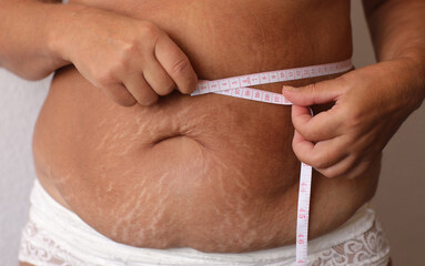 Cropped photo of naked overweight woman belly in underwear, trying to lose weight. Holding and measuring her waistline by roulette tape belly, abdomen. Fat large sagging folds on stomach. Excess skin