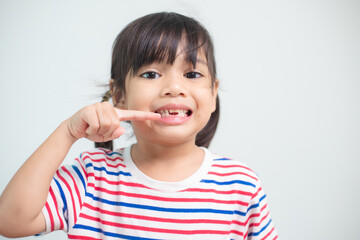 little Asian girl showing her broken milk teeth.