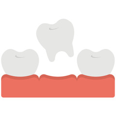 Tooth Extraction