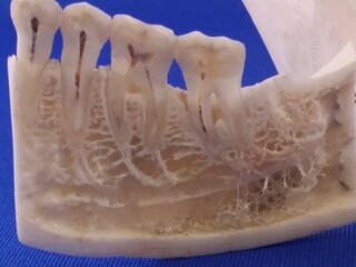 Schädel, Anatomie, anatomy, skull, bone